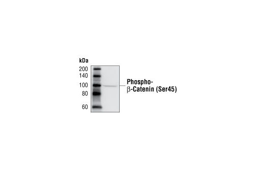 Western Blotting Image 3: Phospho-β-Catenin (Ser45) Antibody