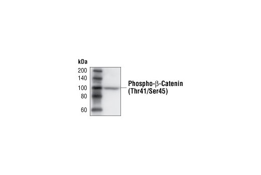 Western Blotting Image 2: Phospho-β-Catenin (Thr41/Ser45) Antibody