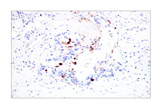 Immunohistochemistry Image 4: Cleaved Caspase-3 (Asp175) (D3E9) Rabbit mAb
