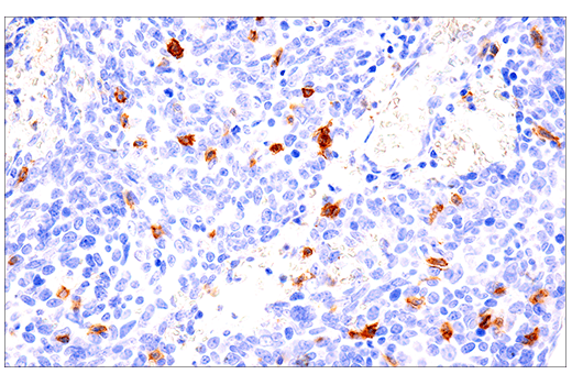 Immunohistochemistry Image 3: CD103/ITGAE (EP206) Rabbit mAb