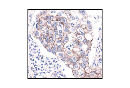 Immunohistochemistry Image 1: β-Catenin Antibody (Carboxy-terminal Antigen)