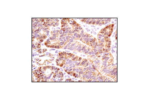 Immunohistochemistry Image 4: β-Catenin Antibody (Carboxy-terminal Antigen)