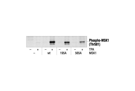  Image 7: Phospho-Erk1/2 Pathway Antibody Sampler Kit