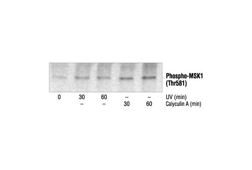  Image 10: Phospho-Erk1/2 Pathway Antibody Sampler Kit
