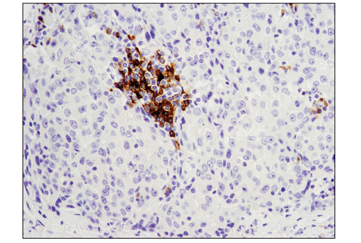 Immunohistochemistry Image 1: CD79B (D7V2F) Rabbit mAb