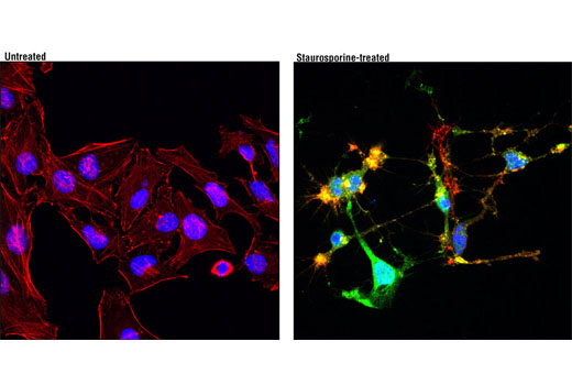 Immunofluorescence Image 1: Cleaved Caspase-3 (Asp175) (D3E9) Rabbit mAb (Alexa Fluor® 488 Conjugate)