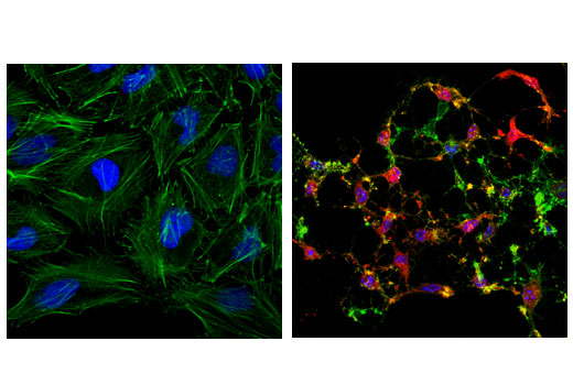 Immunofluorescence Image 1: Cleaved Caspase-3 (Asp175) (D3E9) Rabbit mAb (Alexa Fluor® 555 Conjugate)