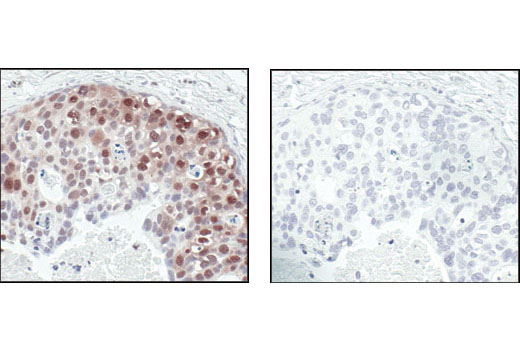 Immunohistochemistry Image 1: Phospho-Akt Substrate (RXXS*/T*) (110B7E) Rabbit mAb