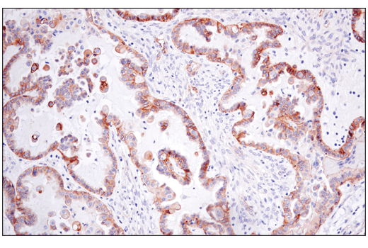 Immunohistochemistry Image 1: CD151 (E4I9J) XP® Rabbit mAb