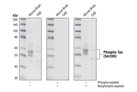  Image 5: PhosphoPlus® Tau (Ser396) Antibody Duet