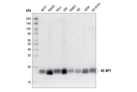  Image 11: 4E-BP Antibody Sampler Kit