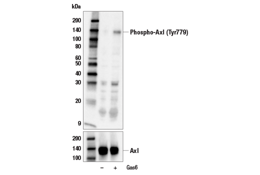 Western Blotting Image 1: Phospho-Axl (Tyr779) Antibody