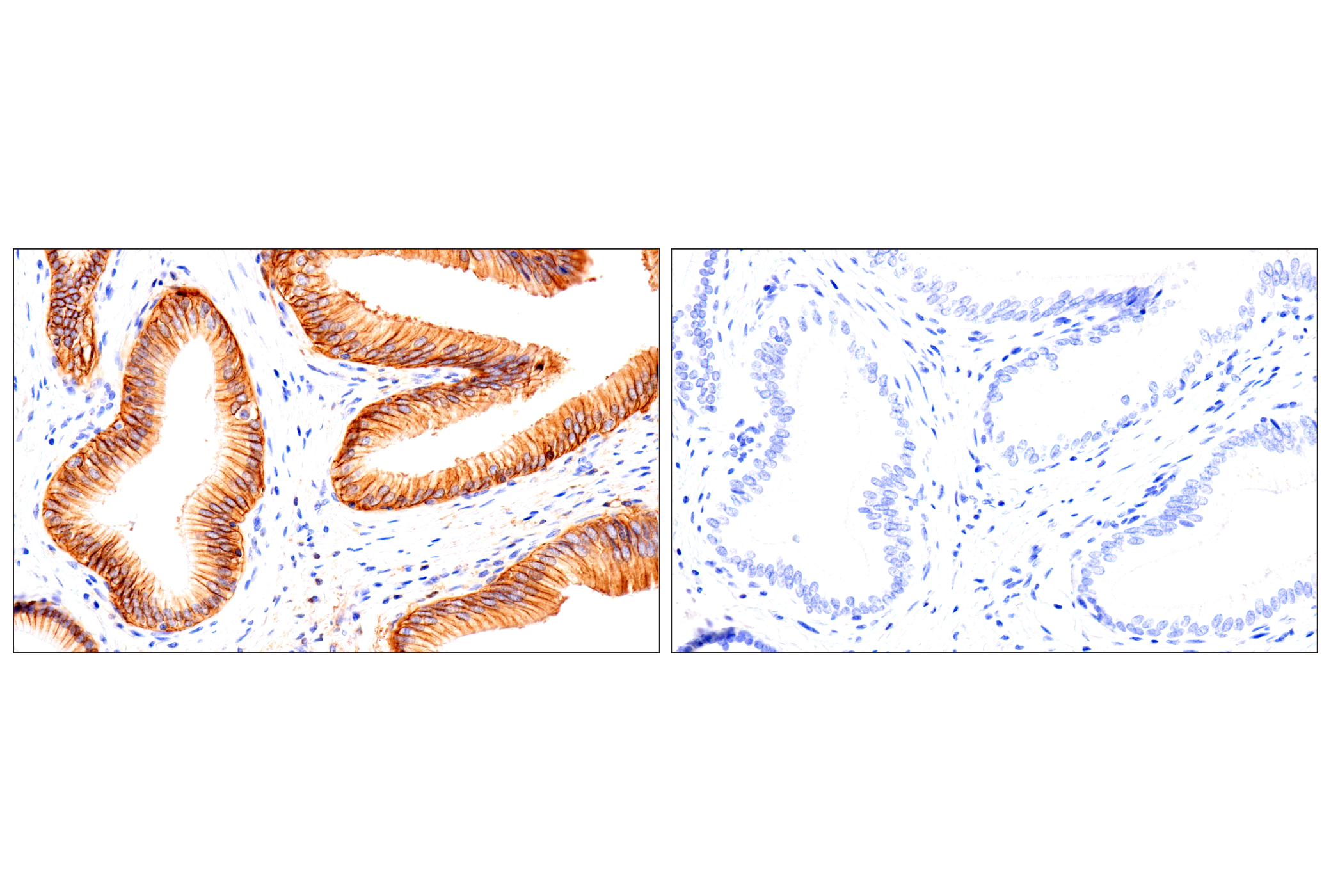 Immunohistochemistry Image 16: Syndecan 1 (E7F7T) Rabbit mAb