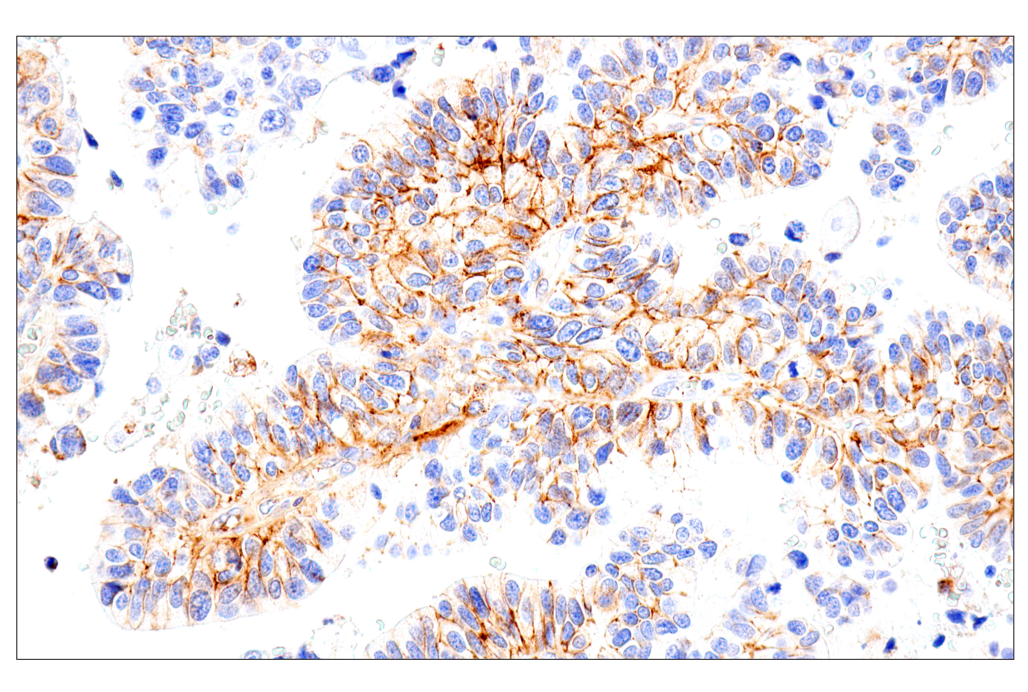 Immunohistochemistry Image 1: Syndecan 1 (E7F7T) Rabbit mAb