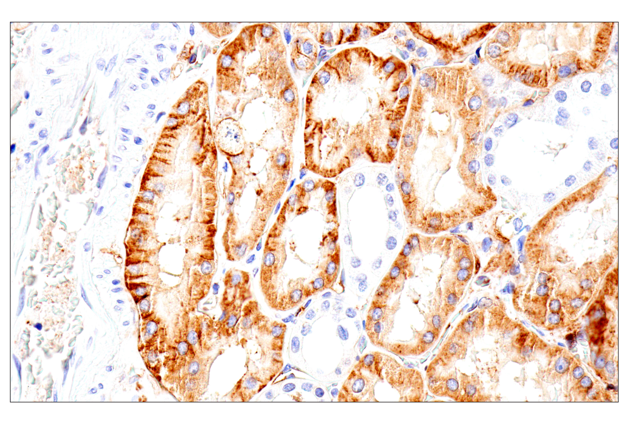 Immunohistochemistry Image 14: Syndecan 1 (E7F7T) Rabbit mAb