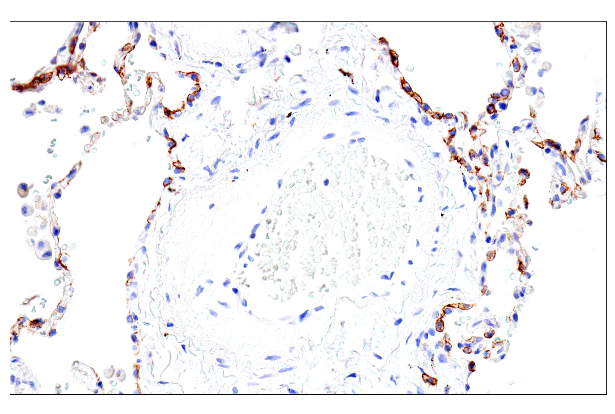 Immunohistochemistry Image 13: Syndecan 1 (E7F7T) Rabbit mAb