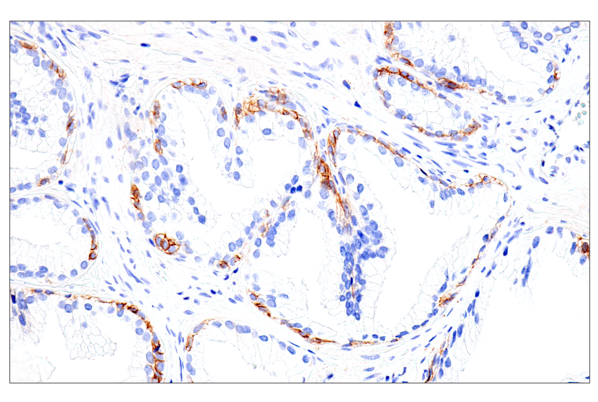 Immunohistochemistry Image 11: Syndecan 1 (E7F7T) Rabbit mAb