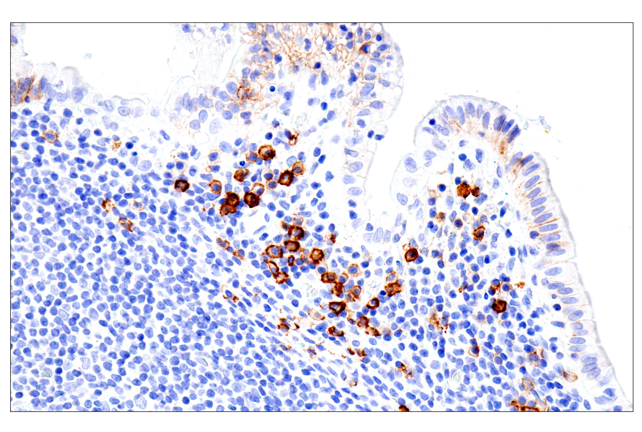 Immunohistochemistry Image 10: Syndecan 1 (E7F7T) Rabbit mAb