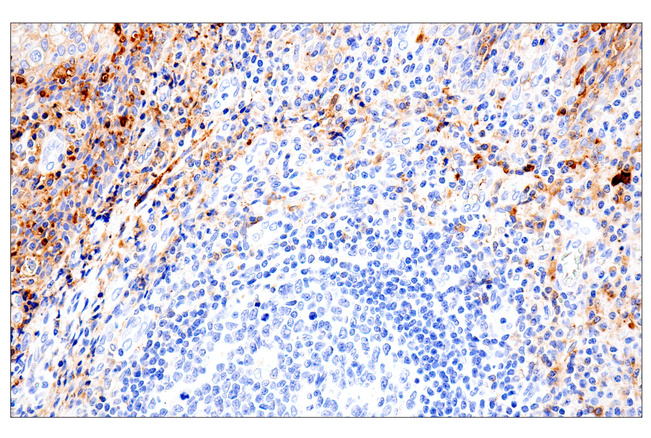 Immunohistochemistry Image 9: Syndecan 1 (E7F7T) Rabbit mAb