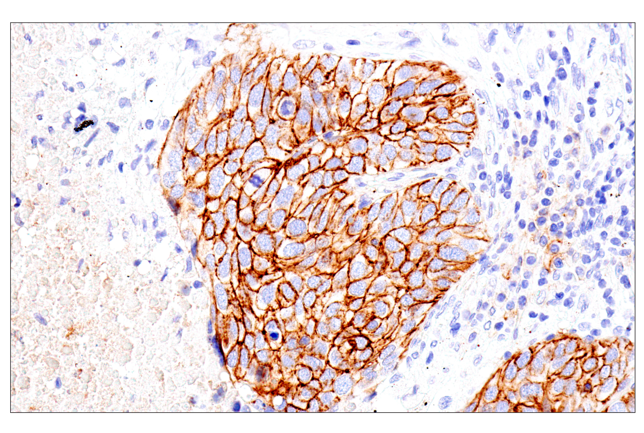 Immunohistochemistry Image 2: Syndecan 1 (E7F7T) Rabbit mAb