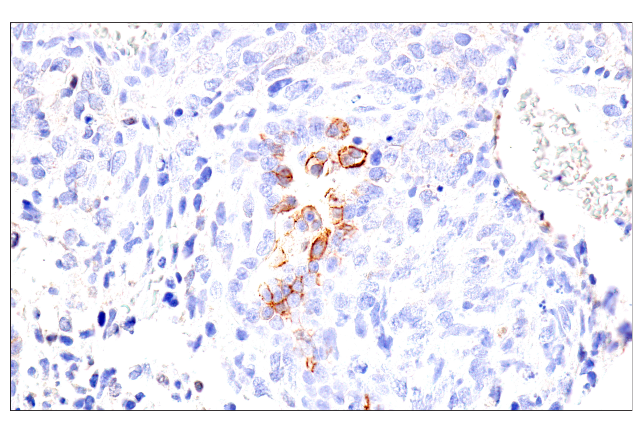 Immunohistochemistry Image 3: Syndecan 1 (E7F7T) Rabbit mAb