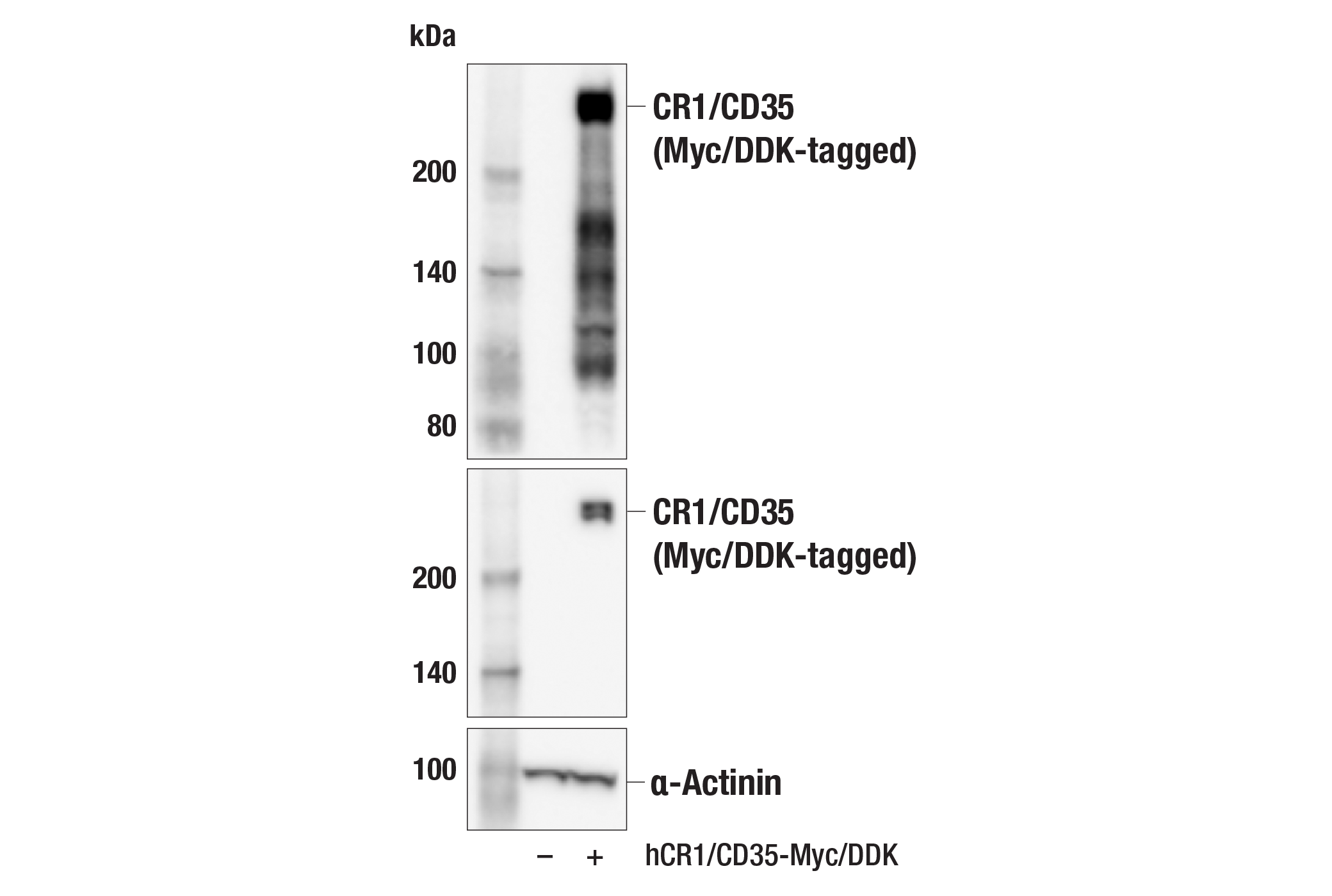 Western Blotting Image 2: CR1/CD35 (E8B1Z) Rabbit mAb