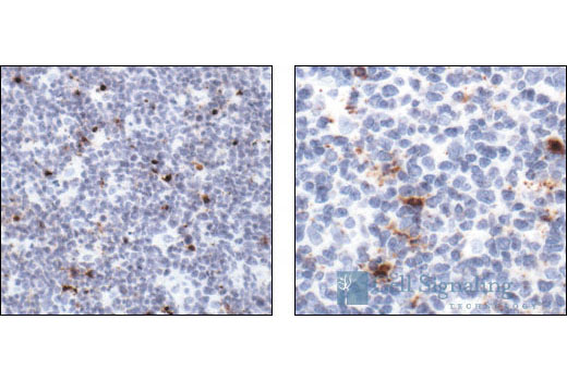 Immunohistochemistry Image 1: Cleaved Caspase-3 (Asp175) Antibody