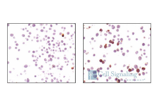  Image 26: β-Amyloid Mouse Model Neuronal Viability IF Antibody Sampler Kit