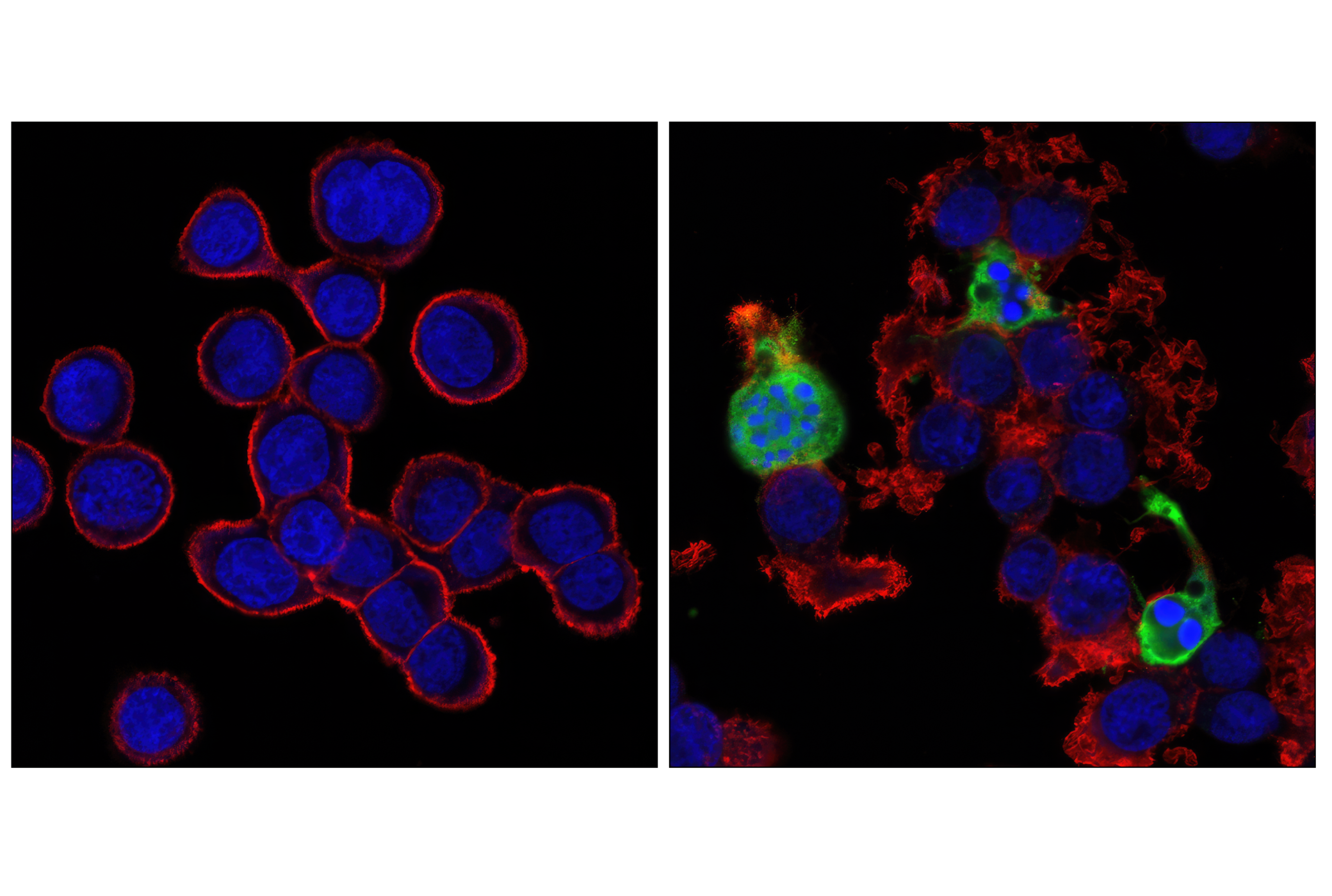  Image 48: Tau Mouse Model Neuronal Viability IF Antibody Sampler Kit