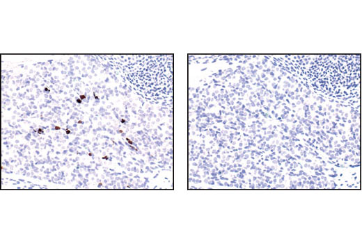  Image 31: Mouse Reactive Cell Death and Autophagy Antibody Sampler Kit