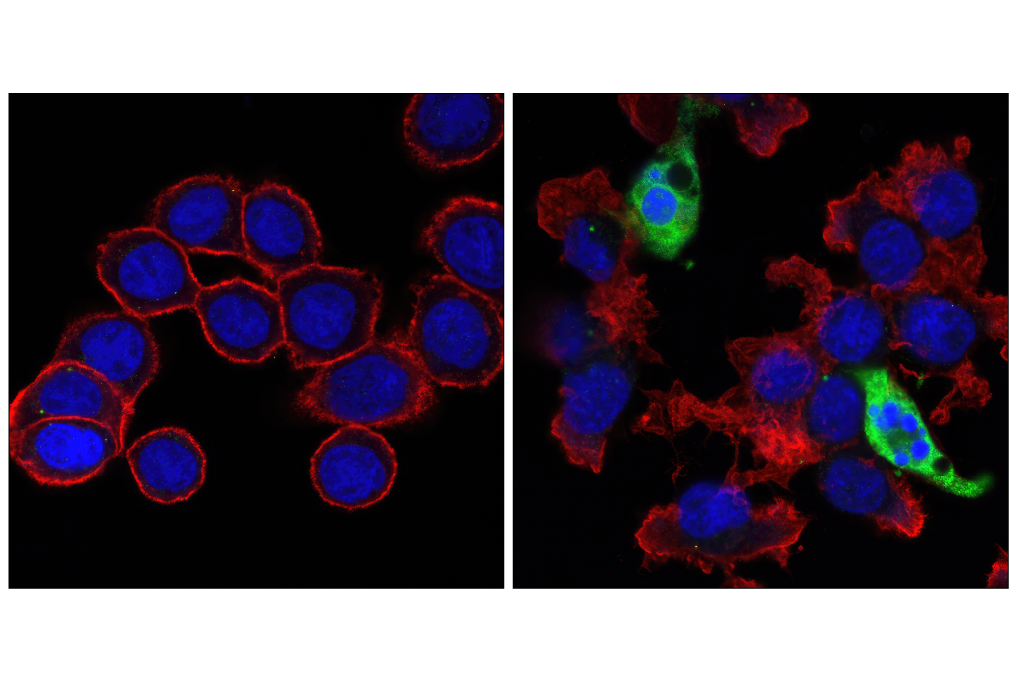 Immunofluorescence Image 1: Cleaved Caspase-3 (Asp175) (5A1E) Rabbit mAb