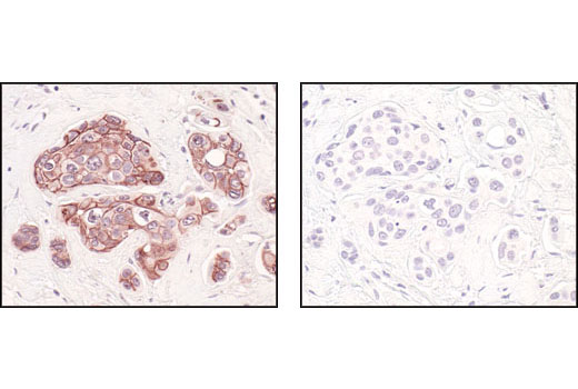 Immunohistochemistry Image 3: E-Cadherin (24E10) Rabbit mAb (BSA and Azide Free)