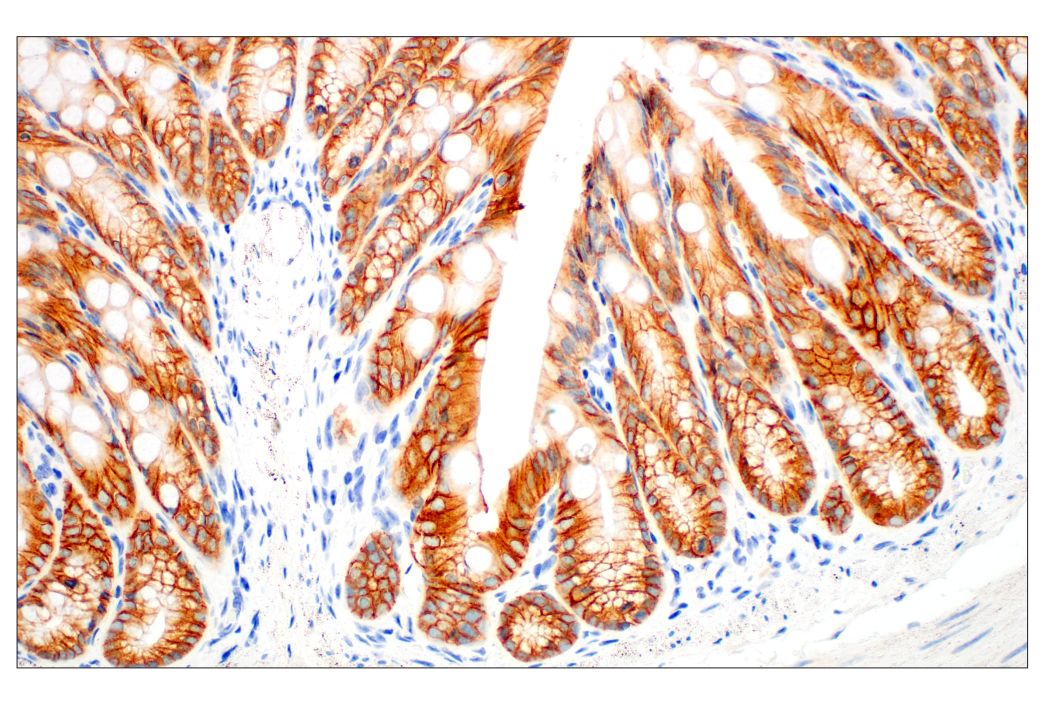 Immunohistochemistry Image 7: E-Cadherin (24E10) Rabbit mAb (BSA and Azide Free)