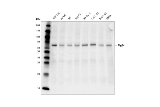  Image 11: Beclin-1 Complex Antibody Sampler Kit