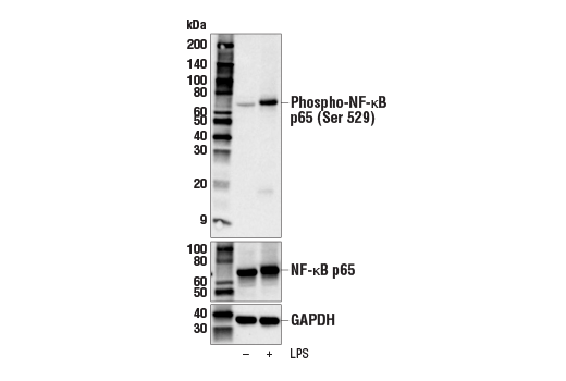 Western Blotting Image 2: Phospho-NF-κB p65 (Ser529) Antibody