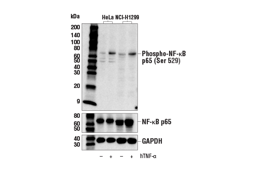 Western Blotting Image 1: Phospho-NF-κB p65 (Ser529) Antibody