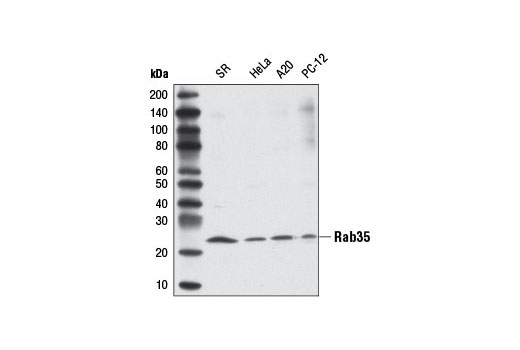 Western Blotting Image 1: Rab35 Antibody