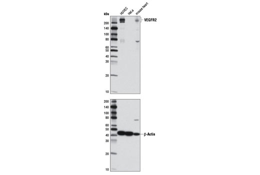 Western Blotting Image 1: VEGF Receptor 2 (D5B1) Rabbit mAb