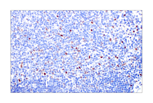 Immunohistochemistry Image 6: T-bet/TBX21 (E4I2K) Rabbit mAb