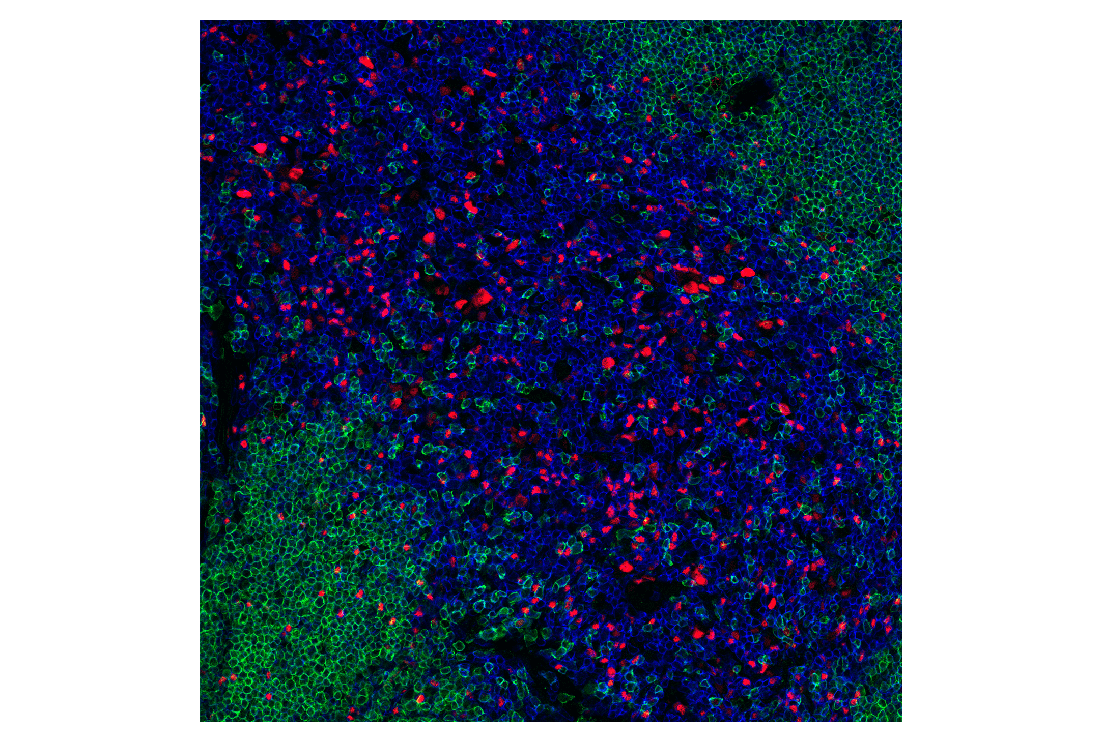 Immunofluorescence Image 1: T-bet/TBX21 (E4I2K) Rabbit mAb