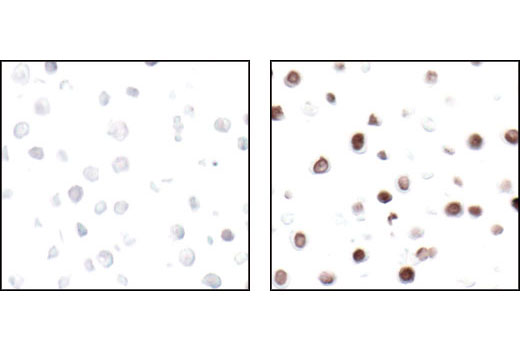 Immunohistochemistry Image 5: Phospho-Histone H2A.X (Ser139) (20E3) Rabbit mAb (BSA and Azide Free)