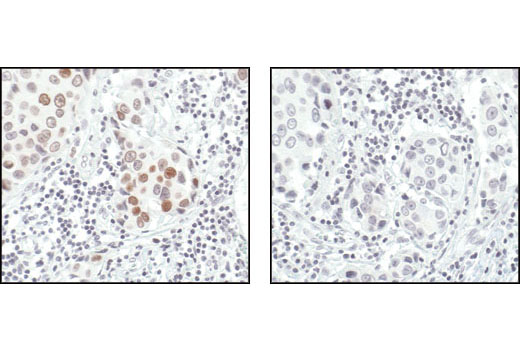 Immunohistochemistry Image 7: Phospho-Histone H2A.X (Ser139) (20E3) Rabbit mAb (BSA and Azide Free)