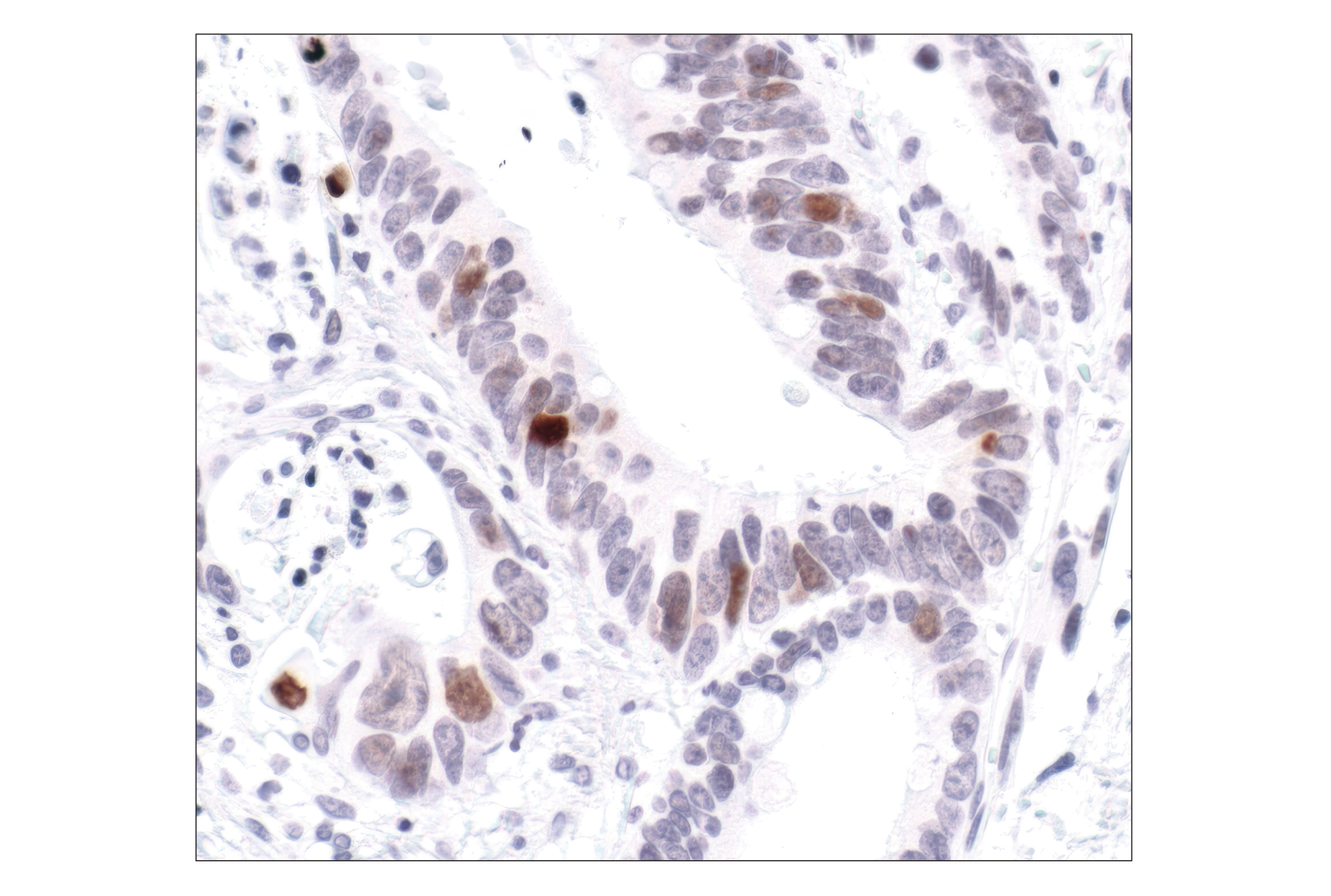 Immunohistochemistry Image 4: Phospho-Histone H2A.X (Ser139) (20E3) Rabbit mAb