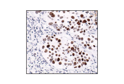 Immunohistochemistry Image 3: Phospho-Histone H2A.X (Ser139) (20E3) Rabbit mAb