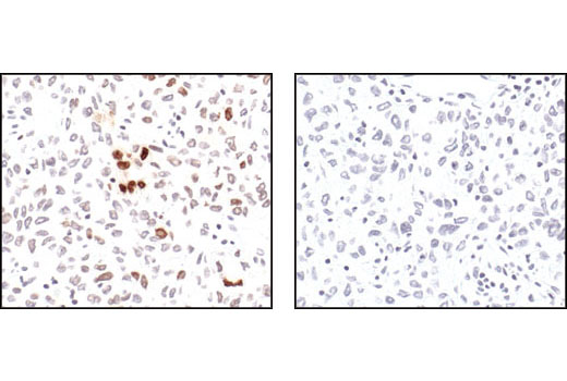 Immunohistochemistry Image 4: Phospho-Histone H2A.X (Ser139) (20E3) Rabbit mAb (BSA and Azide Free)