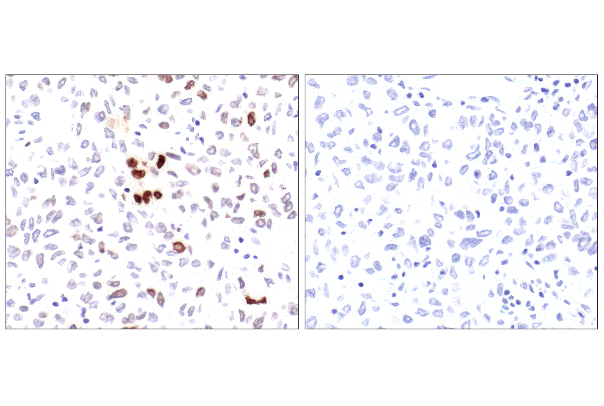 Immunohistochemistry Image 5: Phospho-Histone H2A.X (Ser139) (20E3) Rabbit mAb