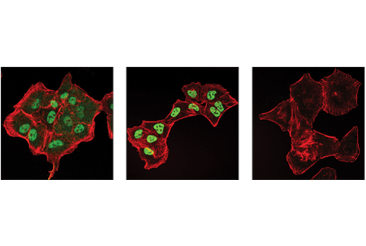 Immunofluorescence Image 1: Phospho-Glucocorticoid Receptor (Ser226) (D9D3V) Rabbit mAb