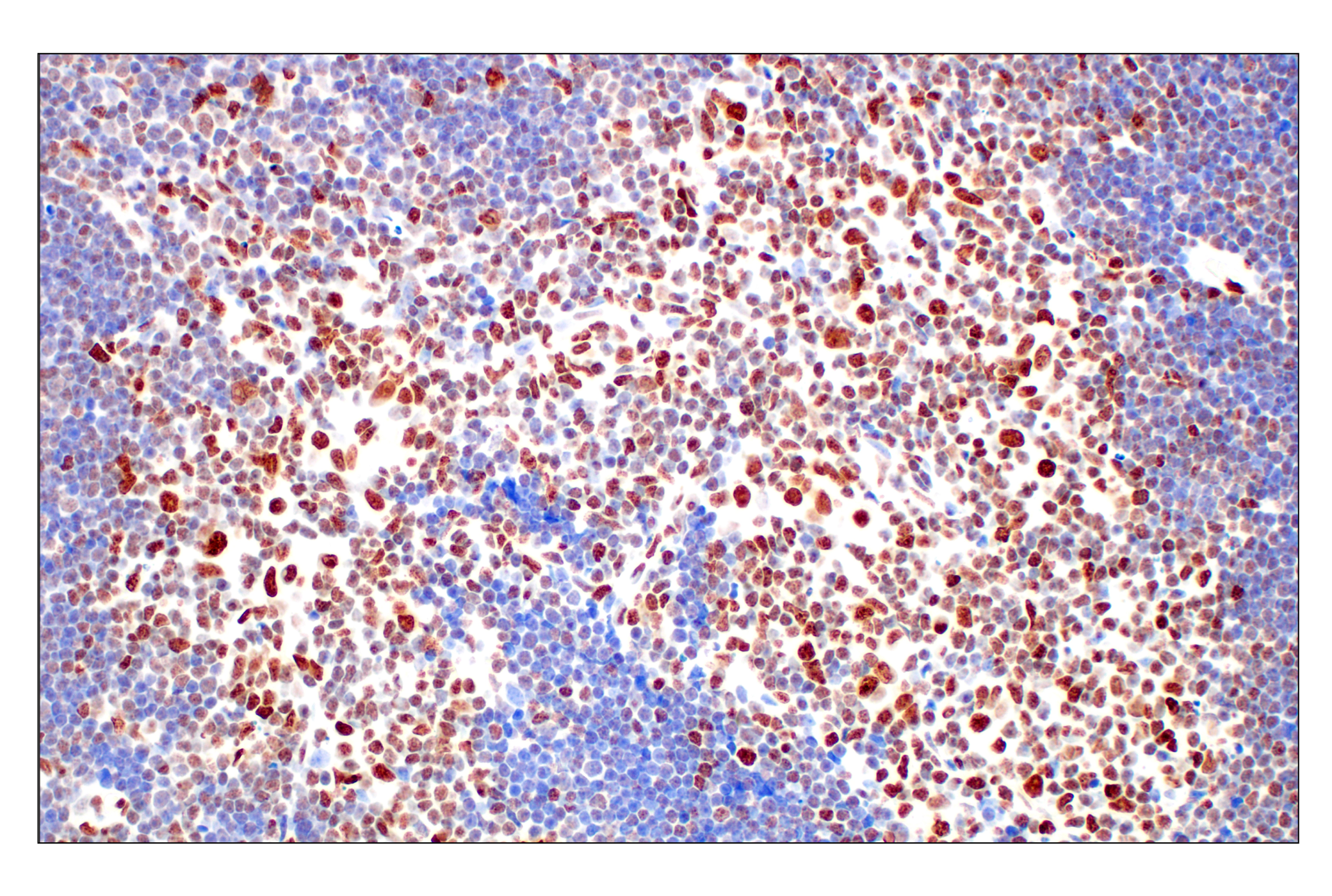  Image 20: Methyl-Histone H3 (Lys27) Antibody Sampler Kit