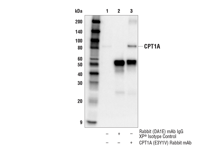 Immunoprecipitation Image 1: CPT1A (E3Y1V) Rabbit mAb