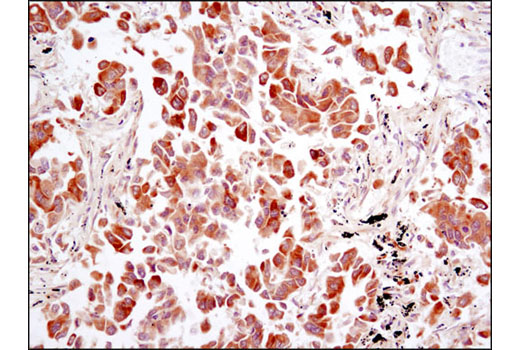  Image 40: Lung Cancer RTK Antibody Sampler Kit